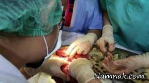 جراحی تومور مغزی ، تکنیک ویژه پزشکی