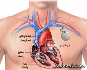 باتری قلب ، چیزهایی در مورد باتری قلب