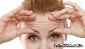 چین روی پیشانی ، چین و چروک روی پیشانی
