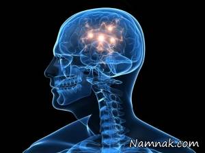 اختلال آتاکسی ، آتاکسی مغز