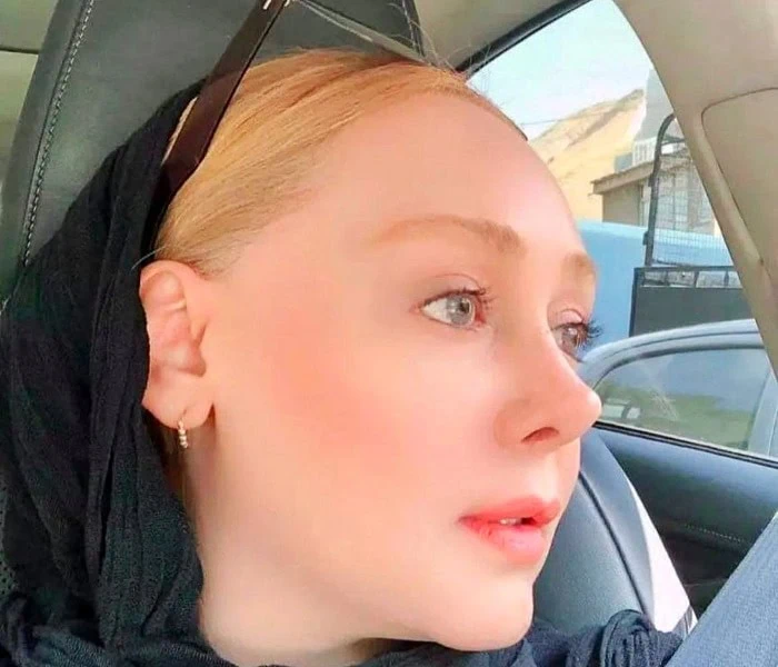 عکس جدید شهره قمر شهره قمر قبل از عمل