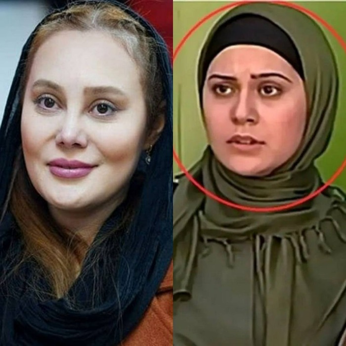 آرام جعفری جراخی زیبایی آرام جعفری