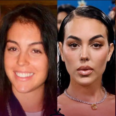 جورجینا رودریگز جورجینا رودریگز نامزد رونالدو قبل از عمل زیبایی