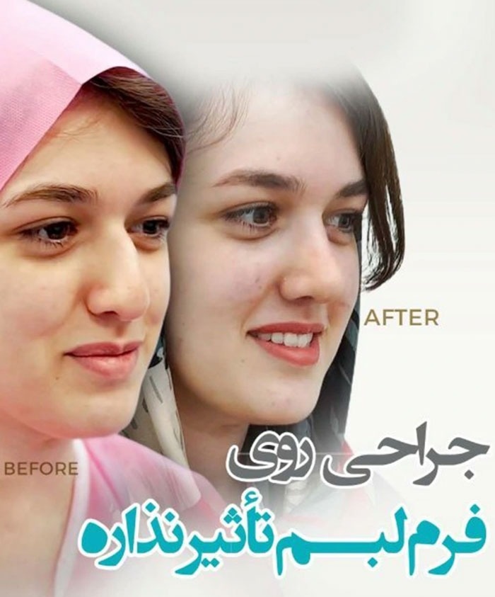 چگونه جراح بینی انتخاب کنیم؟ راهنمای کامل برای یک تصمیم مهم و سرنوشتساز