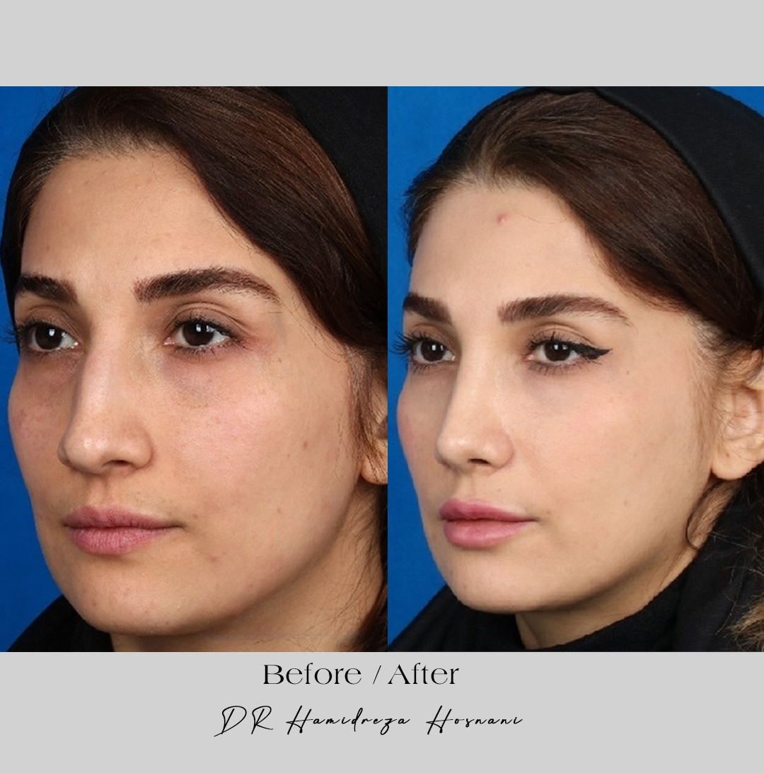 چگونه جراح بینی انتخاب کنیم؟ راهنمای کامل برای یک تصمیم مهم و سرنوشتساز