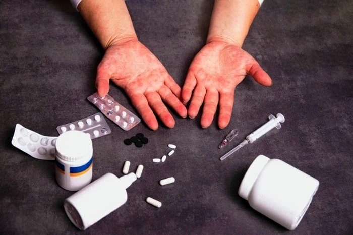 آنتی هیستامین و یبوست آنتی هیستامین