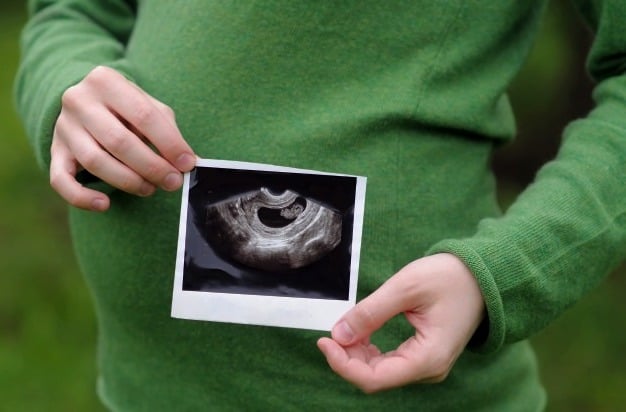 جنین در هفته 29 بارداری