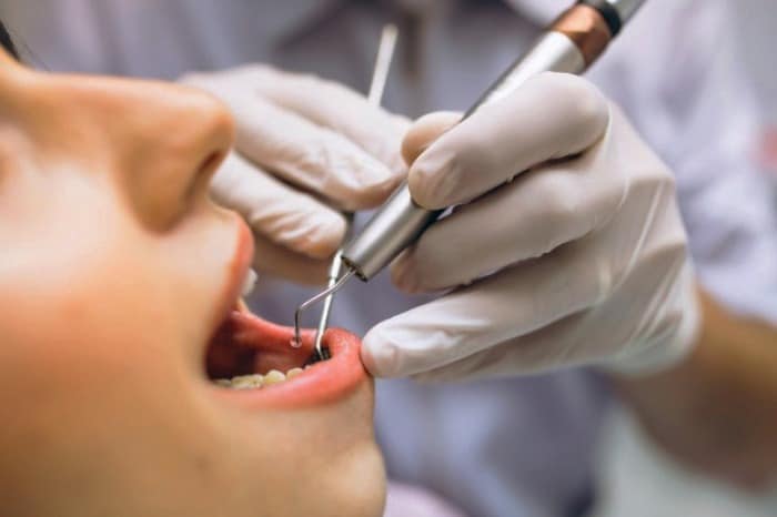 قیمت درمان دندان