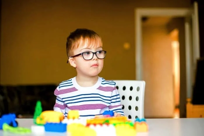 علل بیماری سندرم داون کودک مبتلا به سندرم داون