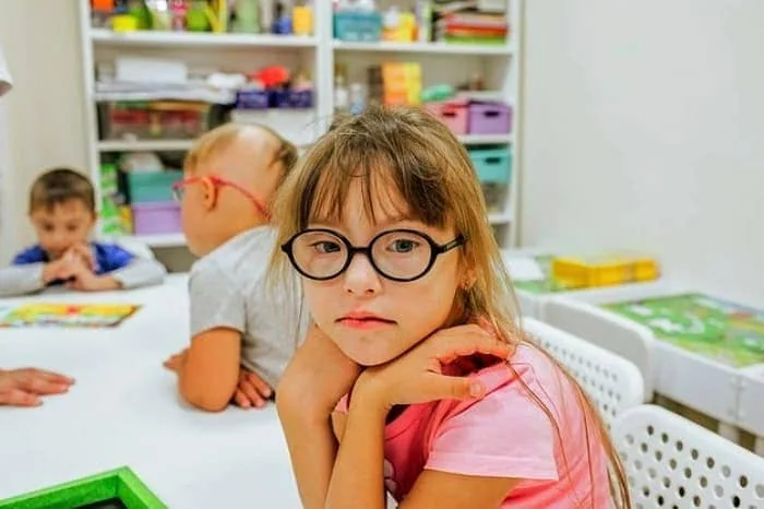 طول عمر افراد مبتلا به سندرم داون افراد مبتلا به سندرم داون