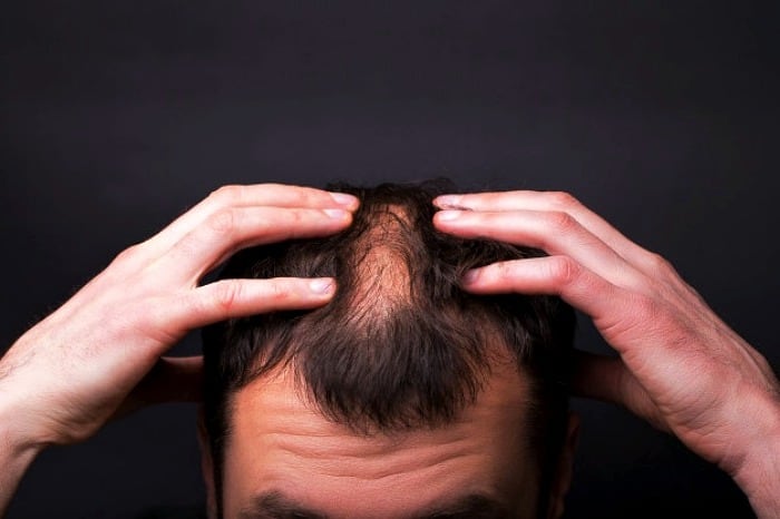 روغن سیاه دانه برای تقویت مو