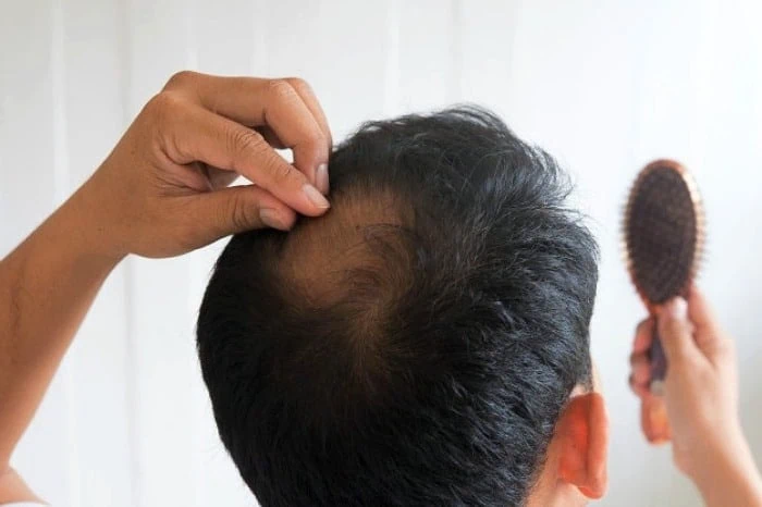 روغن سیاه دانه و مو ماسک موی گیاهی