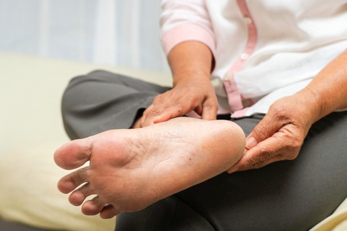 درمان فاشیای کف پا