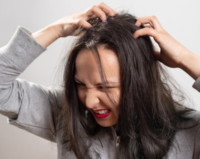 قویترین داروی ضد شپش شامپو ضد شپش