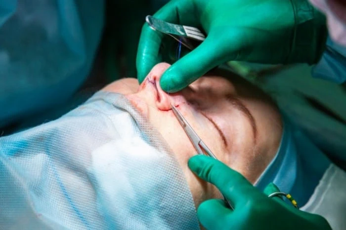 جراحی بینی ترمیمی چگونه است نحوه ترمیم بینی