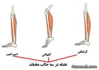 درمان گرفتگی عضلات پا