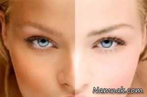 پوست ، دلایل تیره شدن پوست