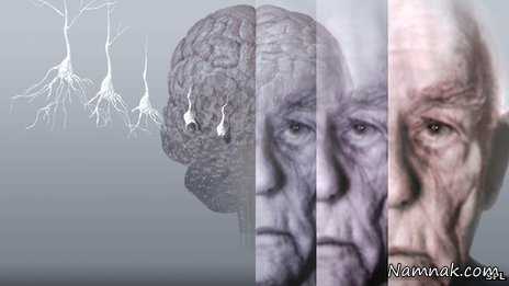 کاهش پیری مغز با مصرف ویتامین B و اسیدهای چرب امگا 3 ، جلوگیری از پیری مغز ، جلوگیری از زوال عقل