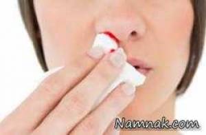 علت خون دماغ شدن ، خون دماغ