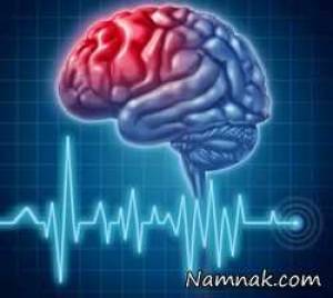علایم سکته مغزی ، علائم سکته مغزی و قلبی