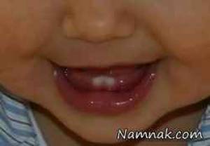 ناهنجاری های فک ، ناهنجاری های فک و صورت