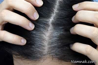 پیشگیری از سفید شدن موها سفید شدن زودرس موها