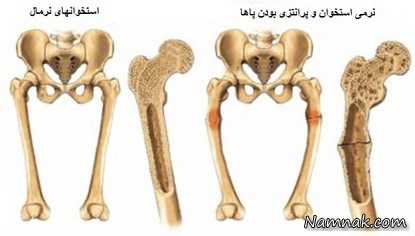 آشنایی با ویتامین D