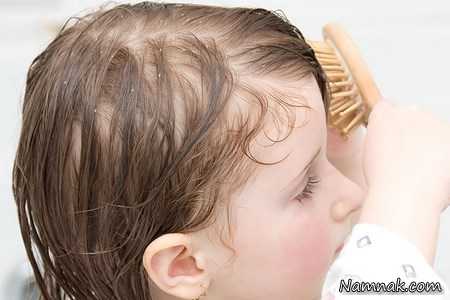 تقویت موهای کودکان