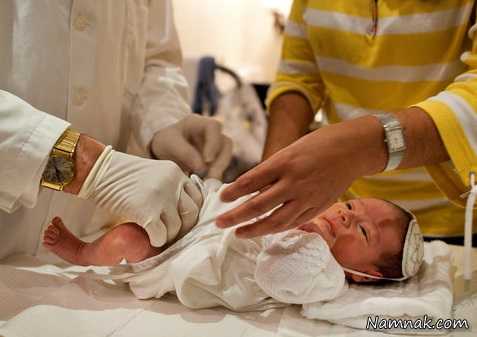 ختنه نوزاد در مشهد
