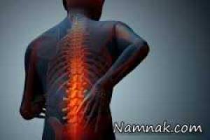 روماتیسم ستون فقرات ، روماتیسم ستون فقرات چیست
