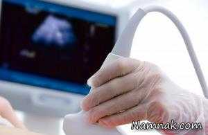 خطرات سونوگرافی های بارداری بر مادر و جنین