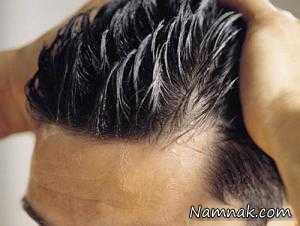 دلایل چرب شدن موی سر و راههای کاهش آن
