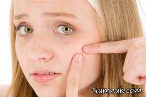 جوش سرسیاه ، جوش سر سیاه بینی