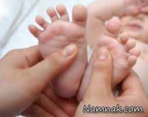 کف پای صاف ، کف پای صاف و عوارض آن
