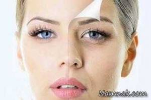 استرس پوست ، استرس بر پوست