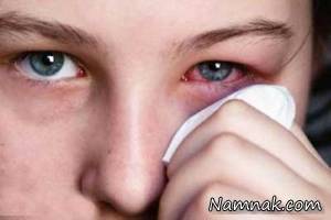 حساسیت چشمی ، گرده افشانی