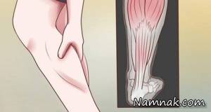 گرفتگی عضلات ، گرفتگی ماهیچه