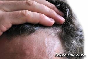 مو ، ظاهر مو