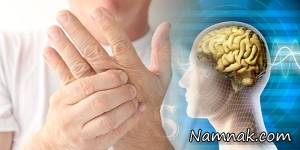 شناسایی بیماری ام اس ، نشانه های ام اس