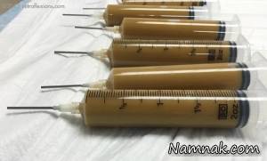 فواید مدفوع انسان ، میکروبیوم روده