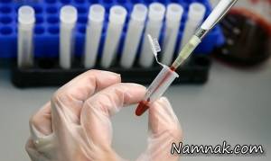 آزمایش ایدز