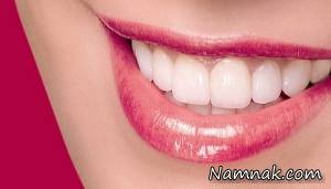 سفید کردن دندان ، راهکار خانگی برای سفیدکردن دندان ها