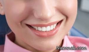 خط خنده ، تاثیر ورزش صورت بر خط خنده