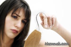 ریزش مو ، درمان ریزش مو