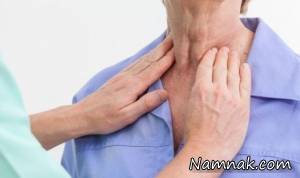 تیروئید ، غذاهای ممنوع در بیماری تیروئید
