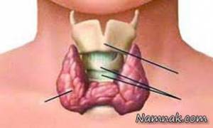 تیروئید ، تیروئید چیست