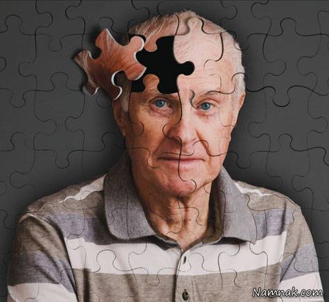پیری ، افراد در معرض آلزایمر ، خطرات از دست دادن کروموزوم