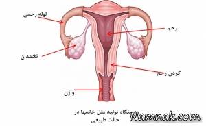 التهاب لگن ، موثرترین روش پیشگیری ازالتهاب لگن