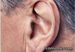 موی گوش ، سلامت