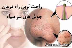 درمان جوش سرسیاه روی بینی